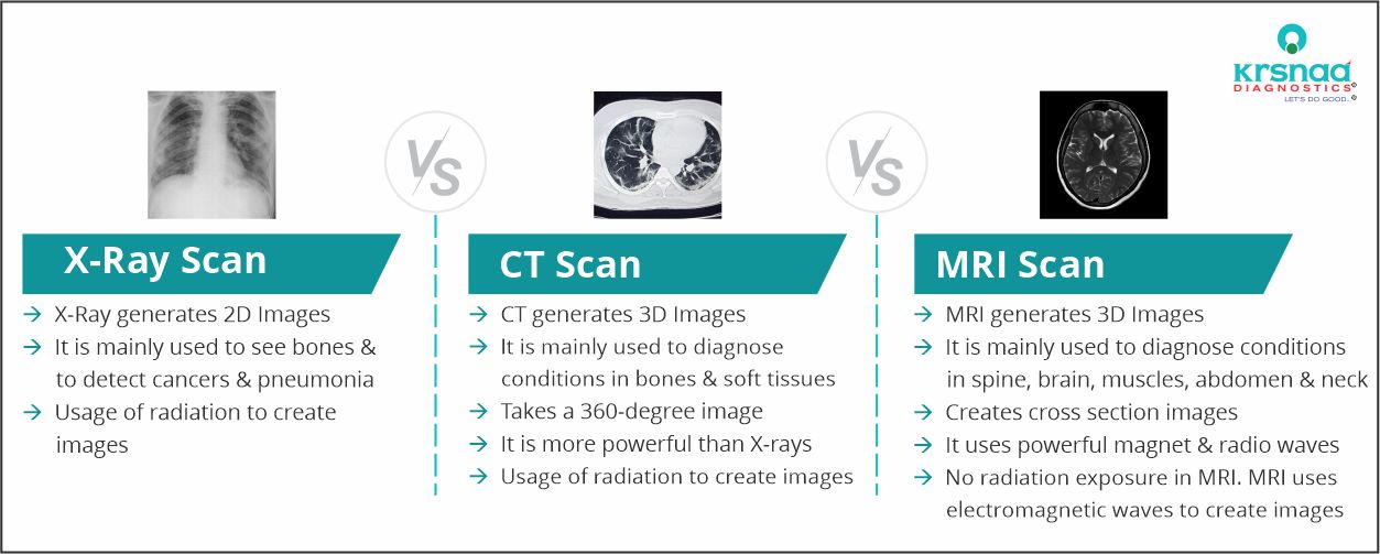 X-Ray vs CT vs MRI Comparison